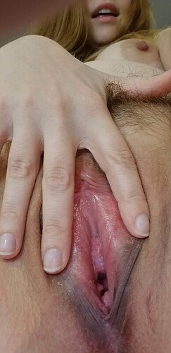 1000001849
