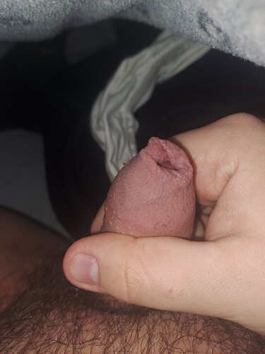 1000029417