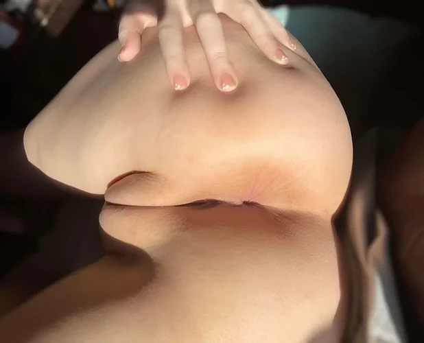 1000072818