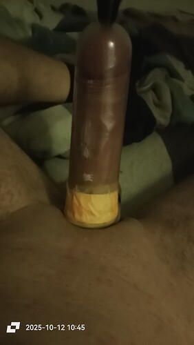 1000033954